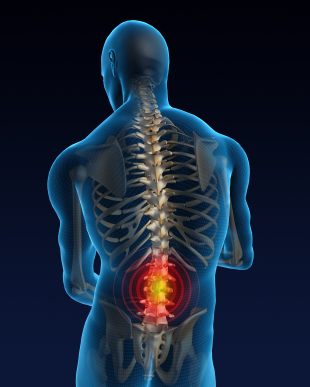 back, pain, discomfort, spine, ache, dysfunction, disfunction, NKT, neurokinetic, therapy, rehabilitation, structure, chatham, summit, nj, short hills, livingston, madison, florham park, new jersey